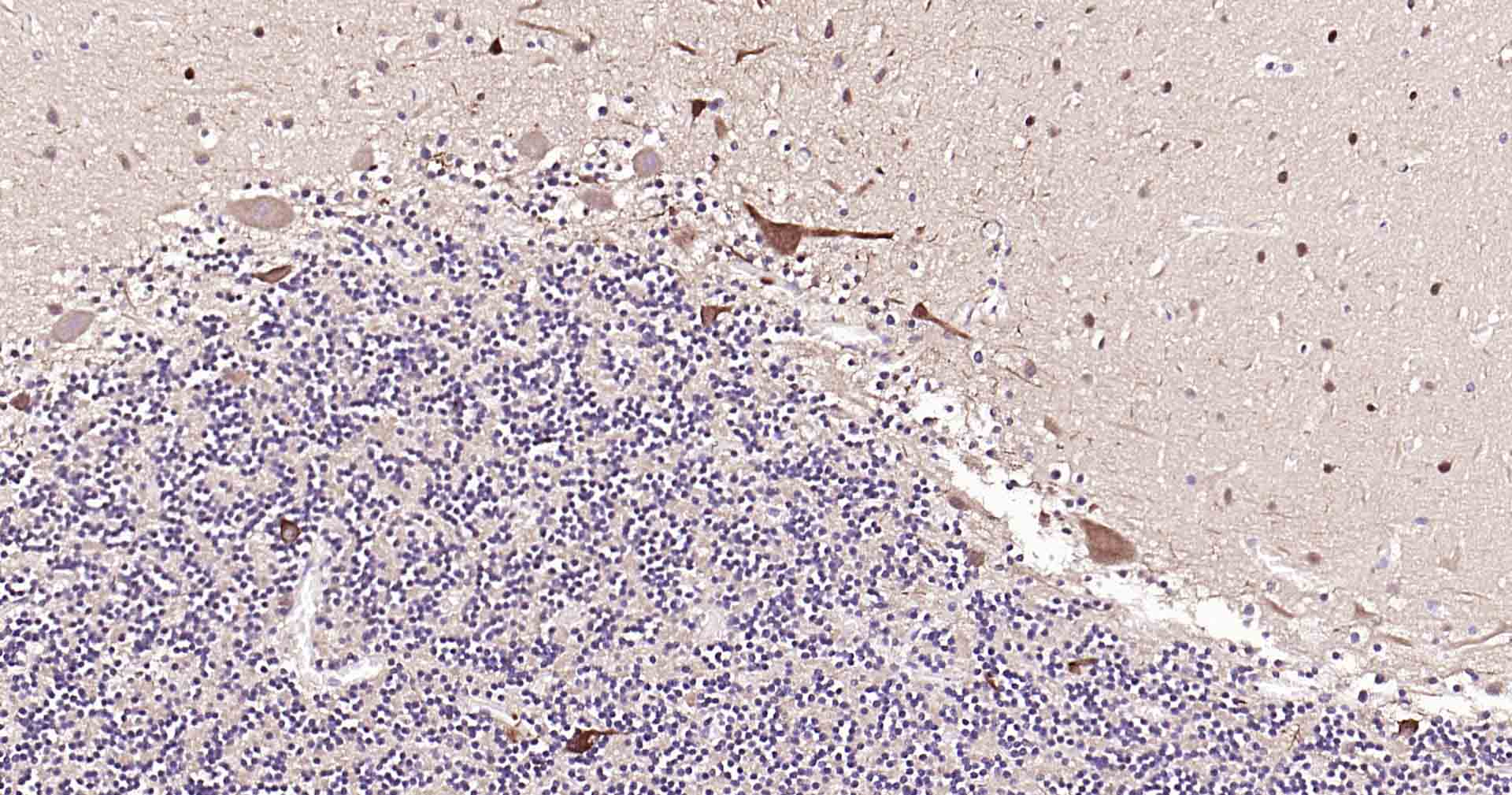 微管相关蛋白2抗体-bs-34252R