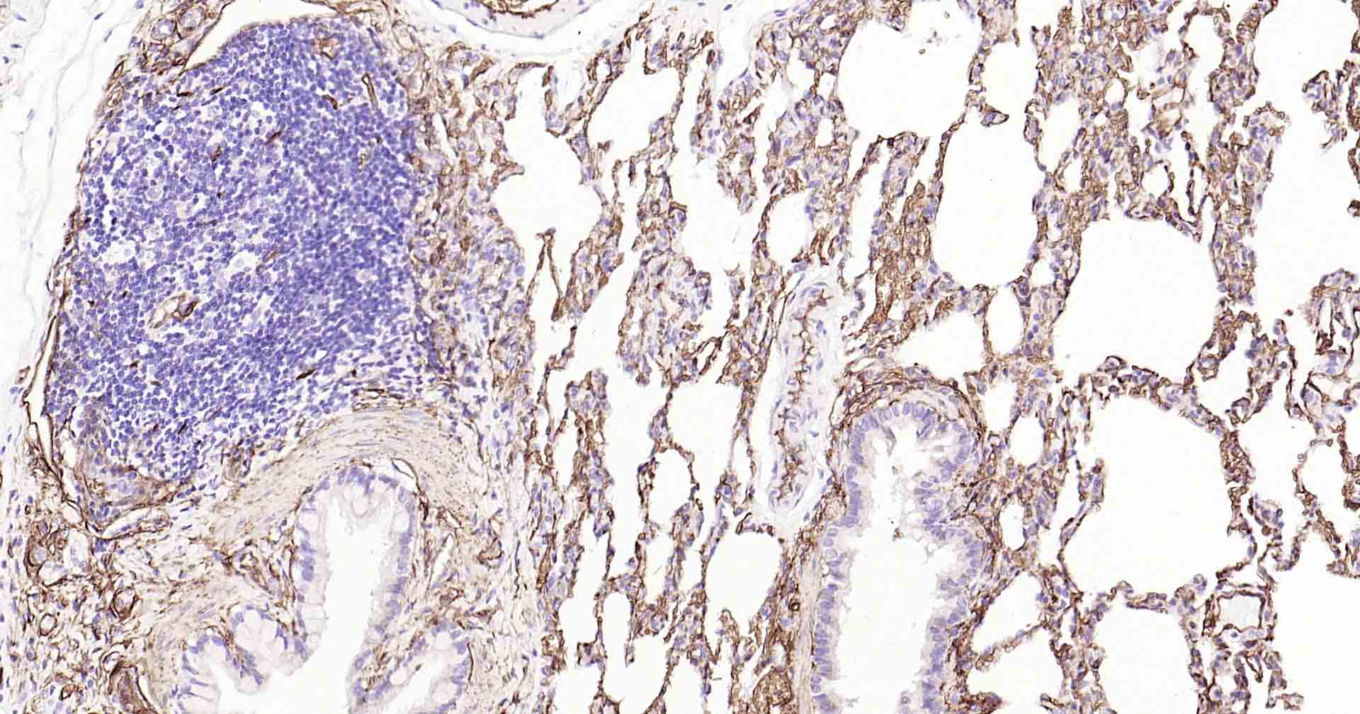 水通道蛋白1重组兔单抗