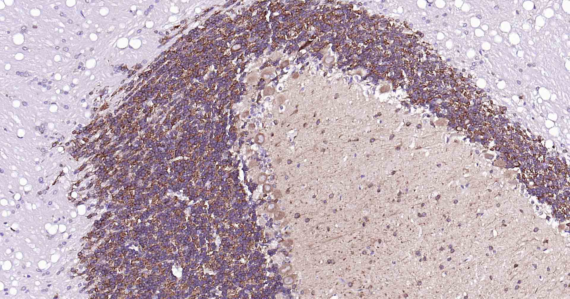 微管相关蛋白2抗体-bs-34252R