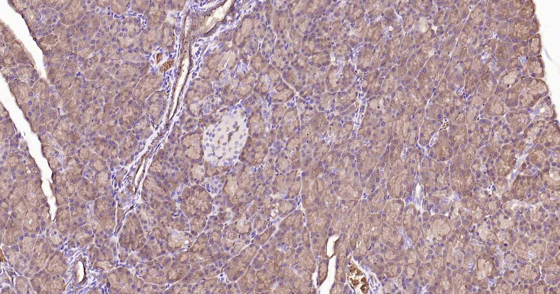 水通道蛋白1重组兔单抗