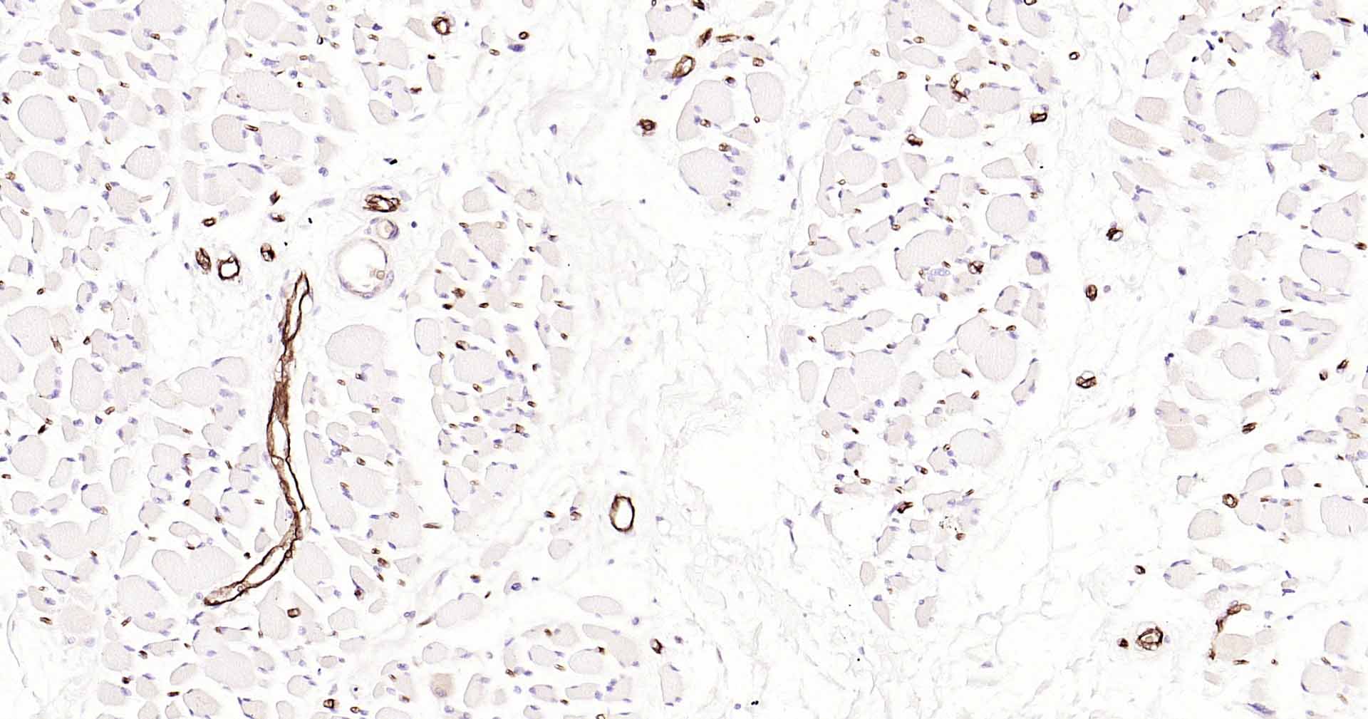 水通道蛋白1重组兔单抗