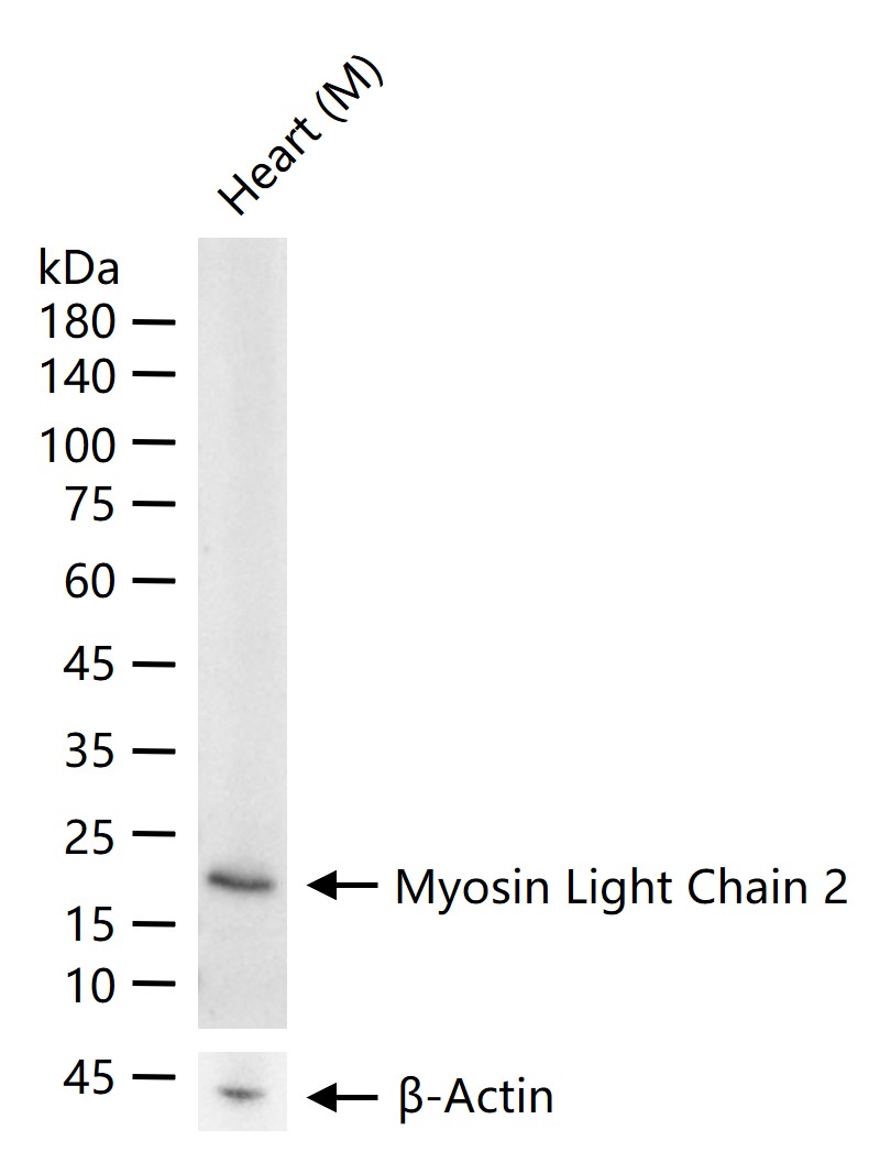 心脏肌球蛋白轻链2重组兔单抗