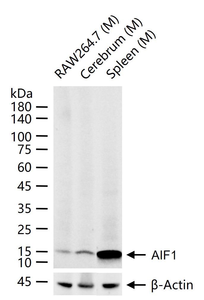 离子钙接头蛋白重组兔单抗
