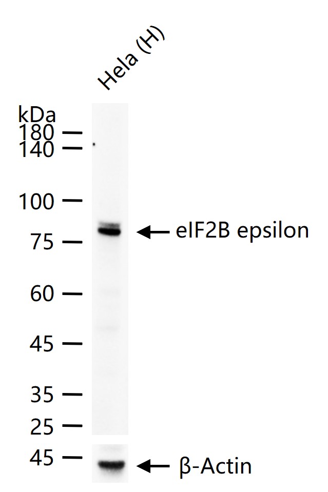 eIF2B epsilon Recombinant Rabbit mAb (一抗) | Bioss