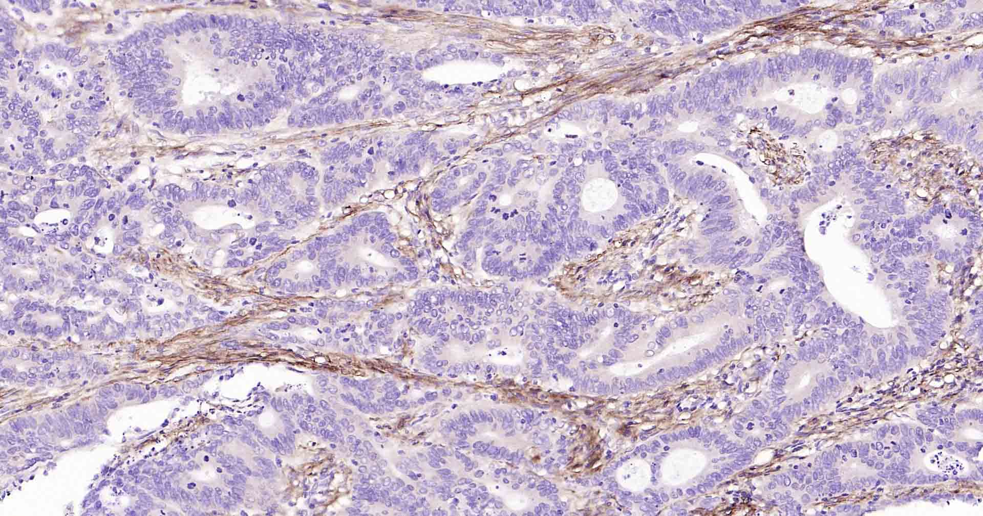 平足蛋白/淋巴管内皮细胞蛋白重组兔单抗