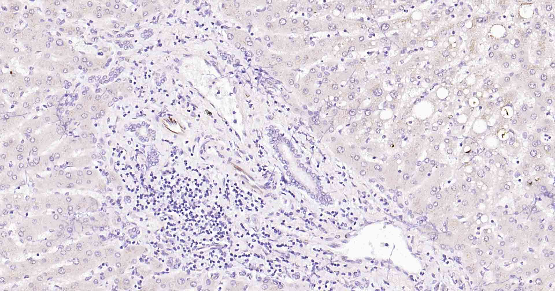 血管内皮生长因子重组兔单抗