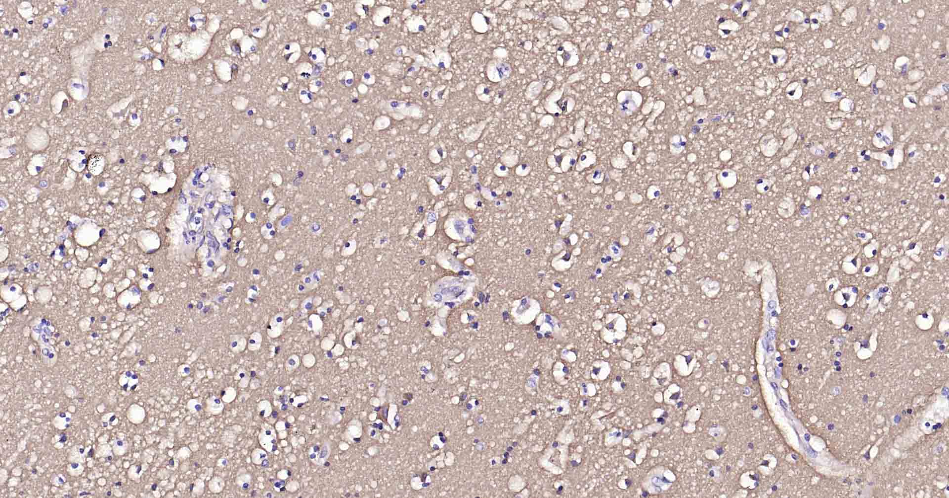 钠钾ATP酶蛋白a1重组兔单抗