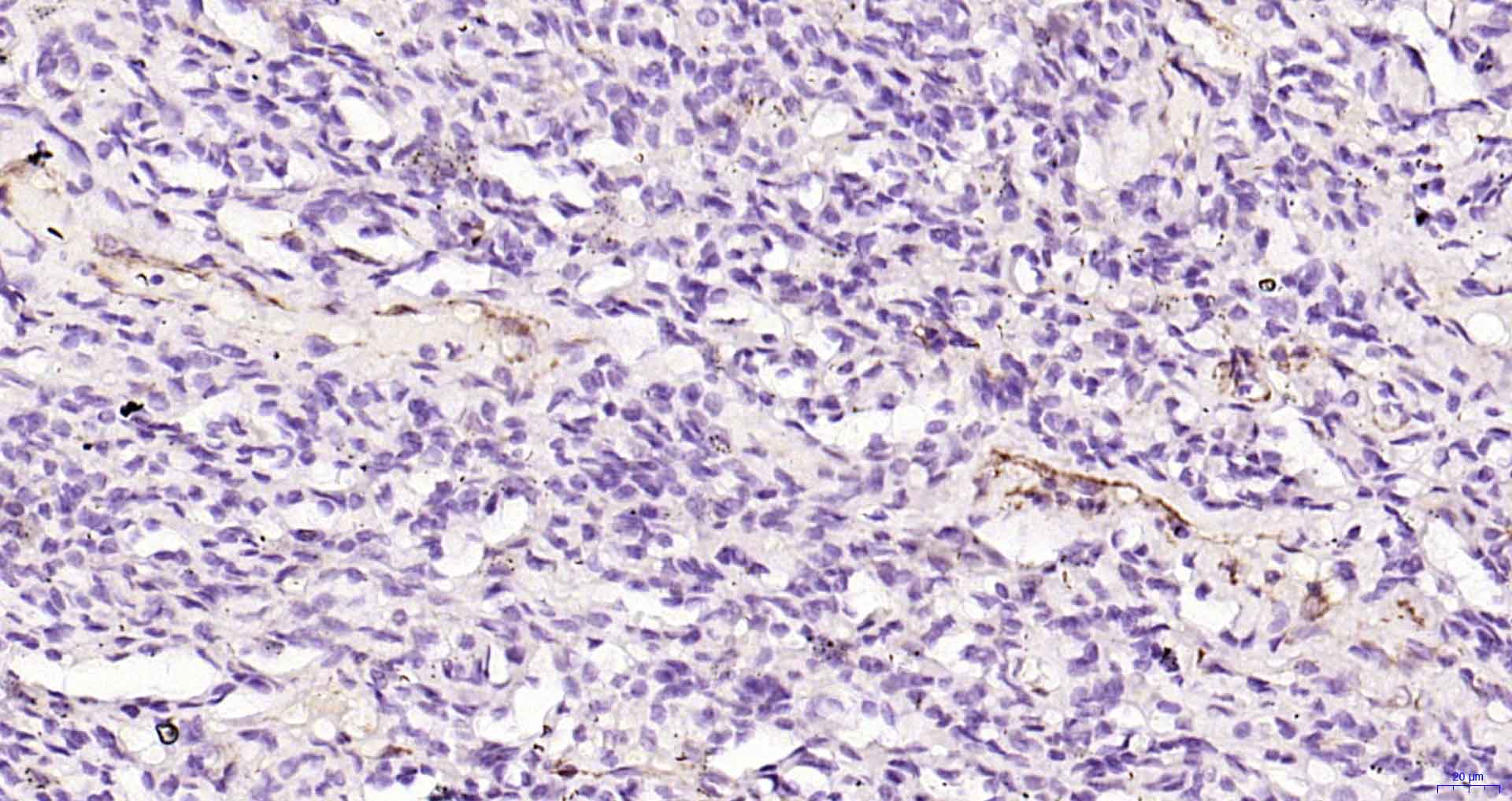 P选择素/白细胞内皮细胞粘附分子3重组兔单抗