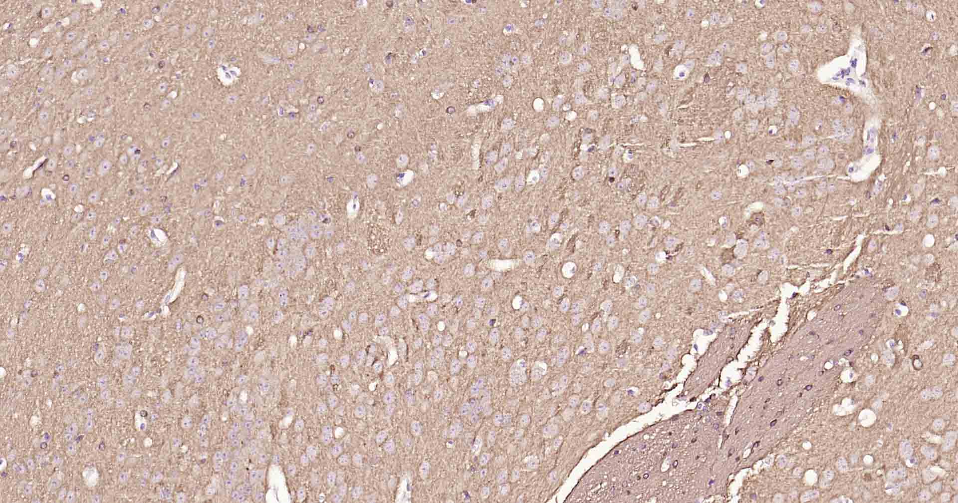 微管相关蛋白重组兔单抗