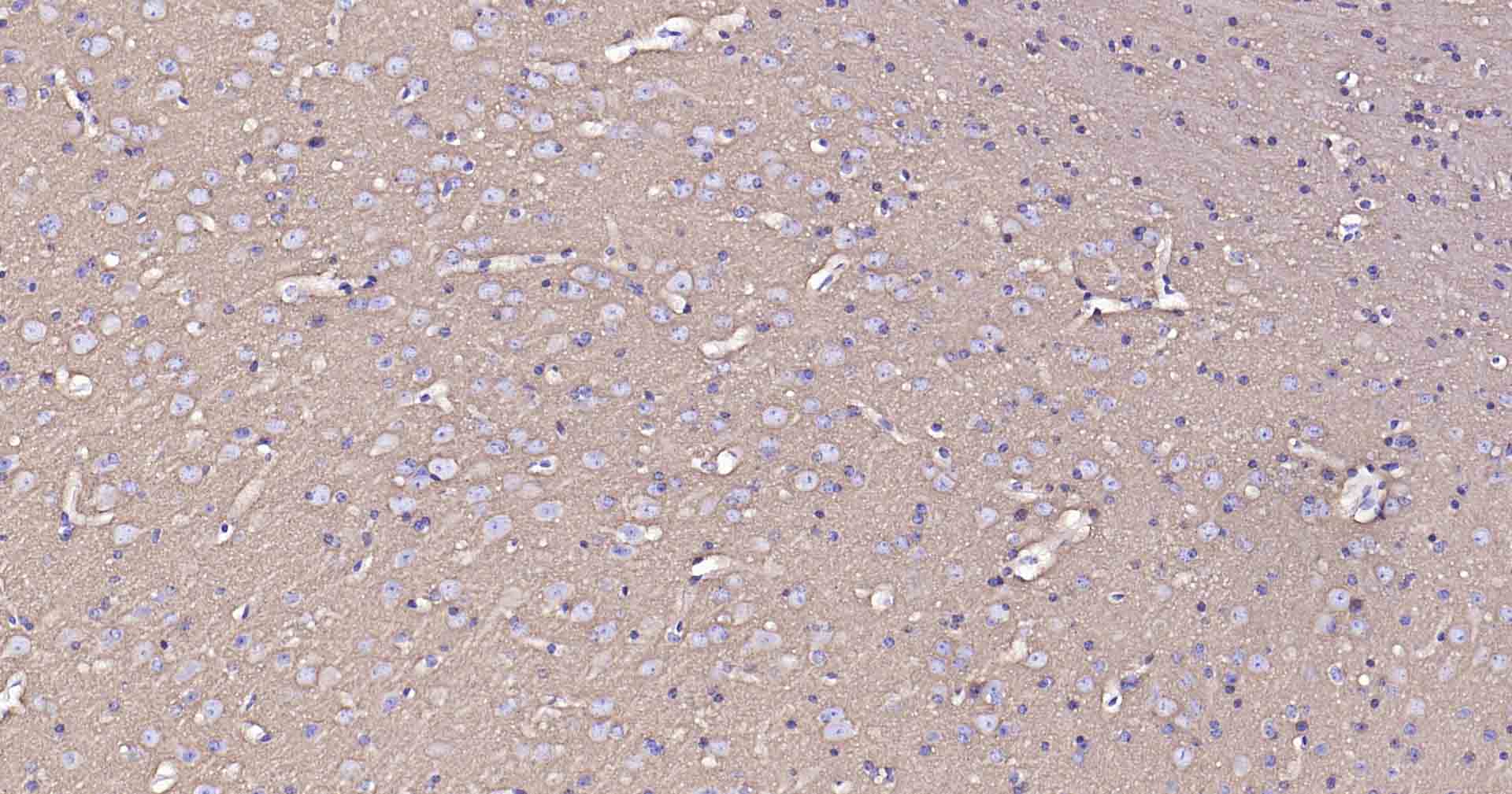 钠钾ATP酶蛋白a1重组兔单抗