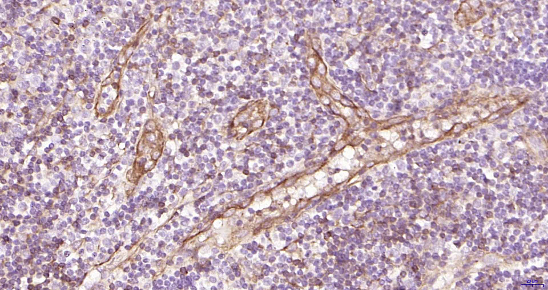 P选择素/白细胞内皮细胞粘附分子3重组兔单抗