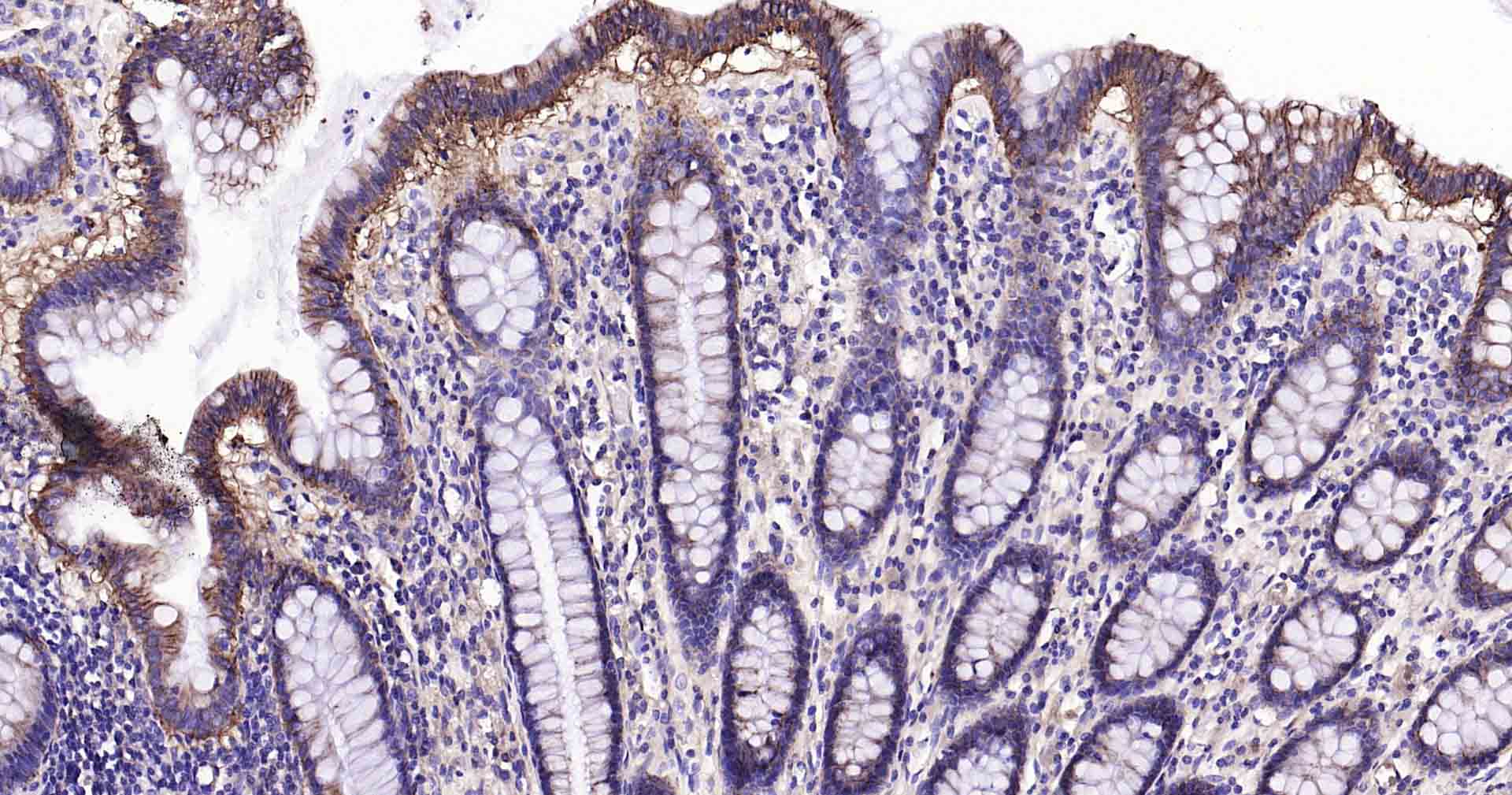 钠钾ATP酶蛋白a1重组兔单抗