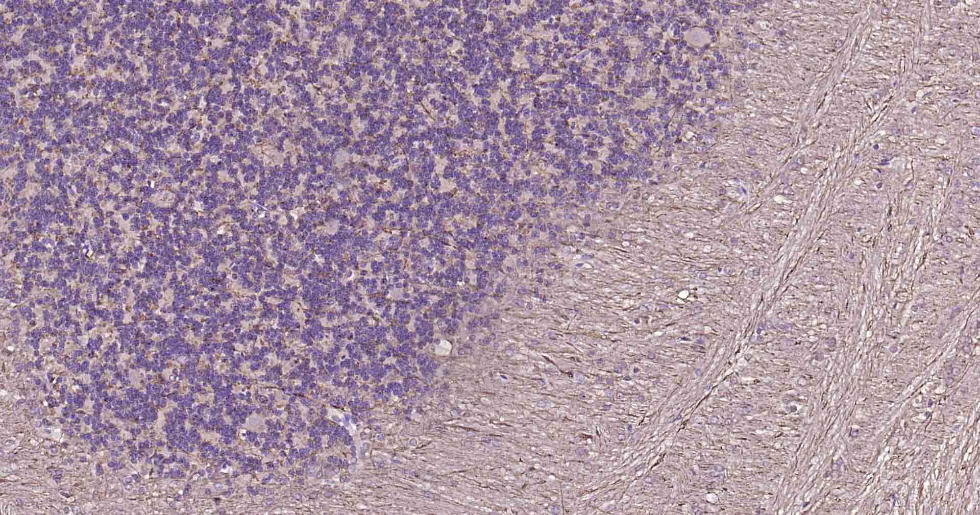 微管相关蛋白重组兔单抗