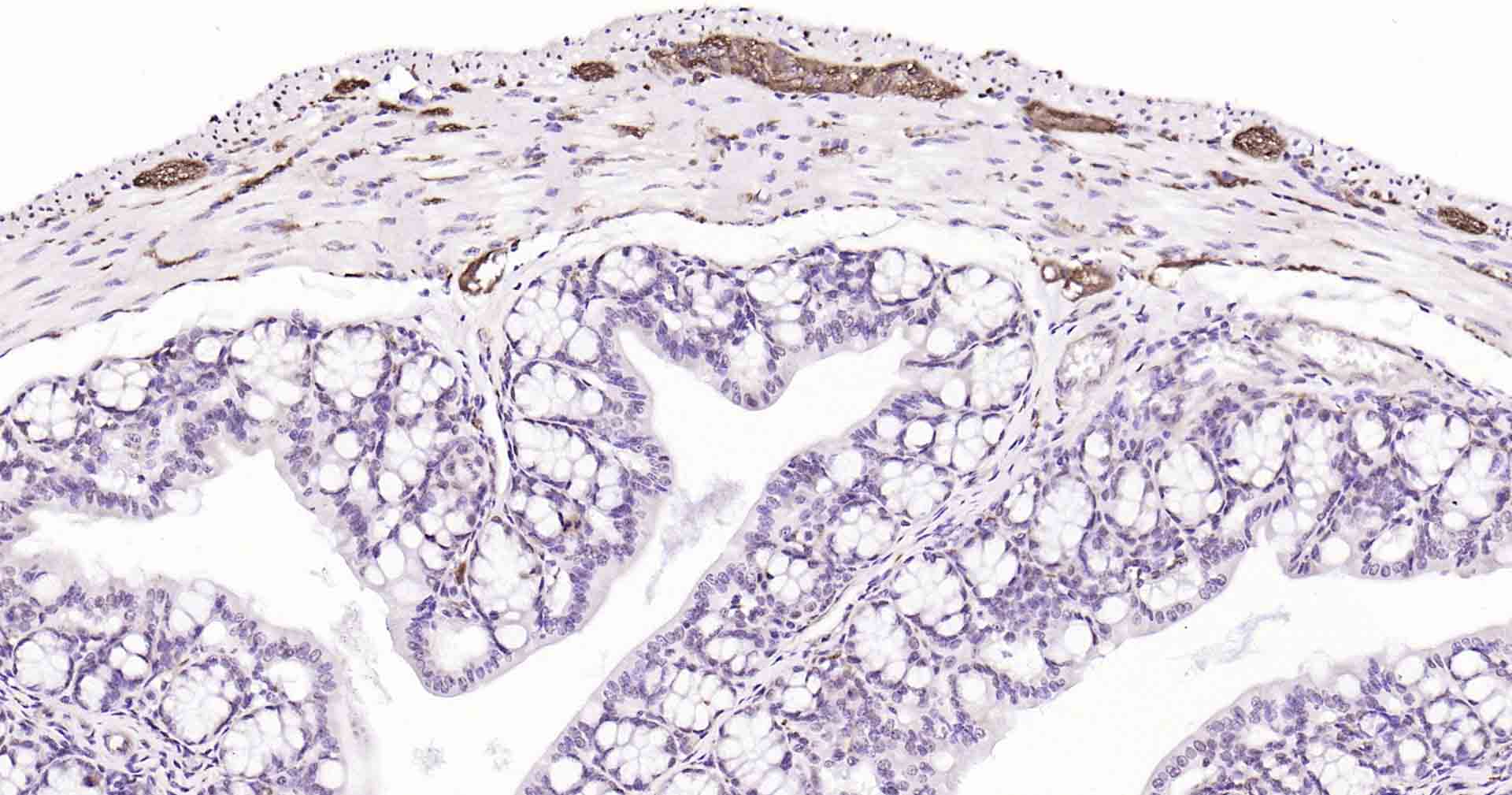 微管相关蛋白重组兔单抗