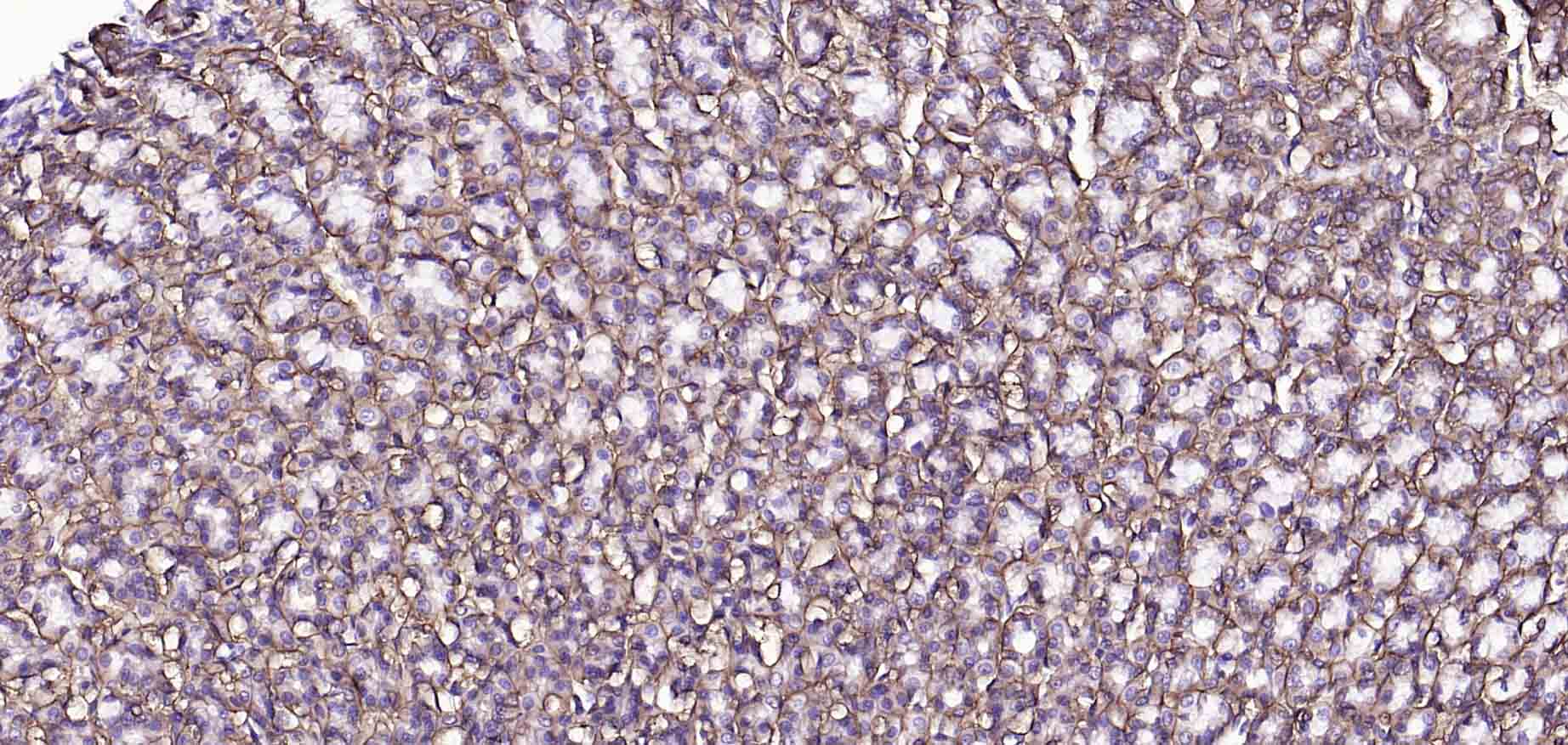 钠钾ATP酶蛋白a1重组兔单抗
