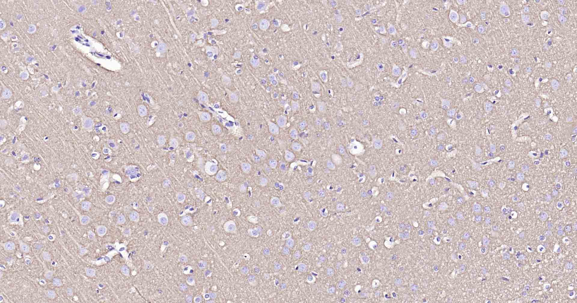 钠钾ATP酶蛋白a1重组兔单抗