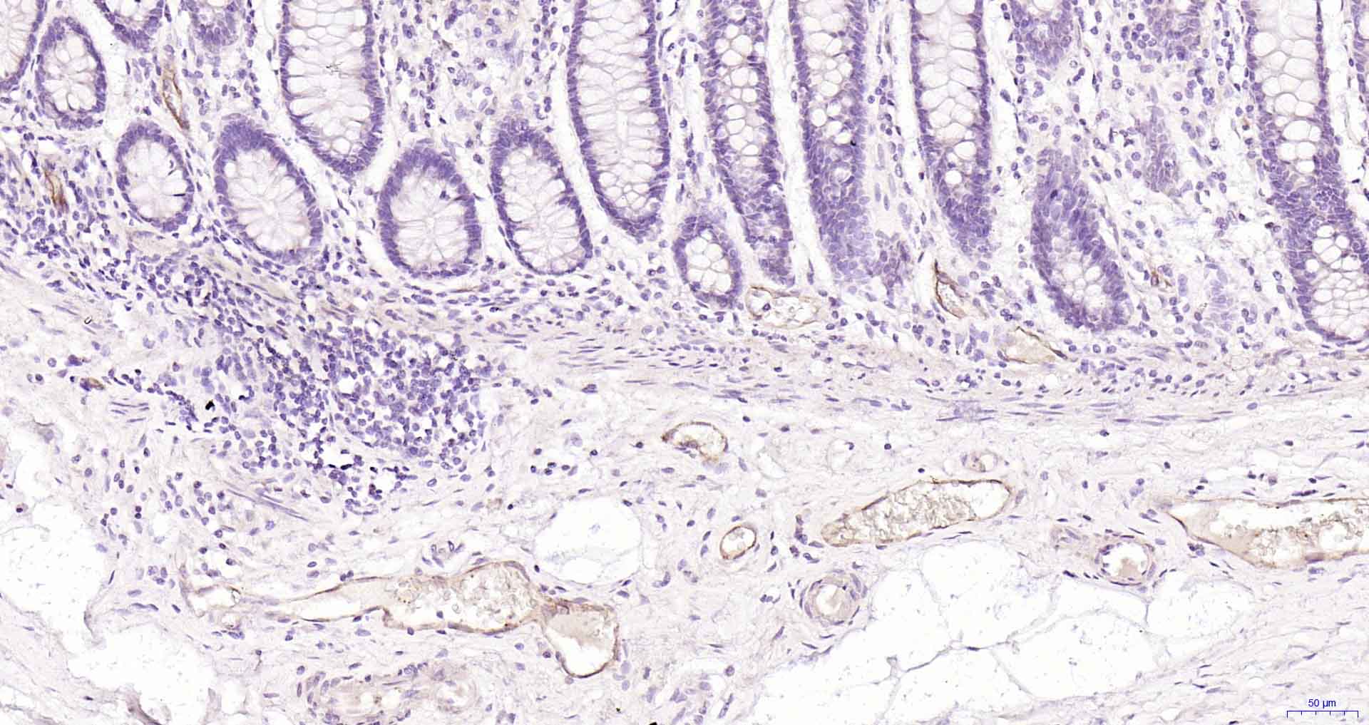 P选择素/白细胞内皮细胞粘附分子3重组兔单抗