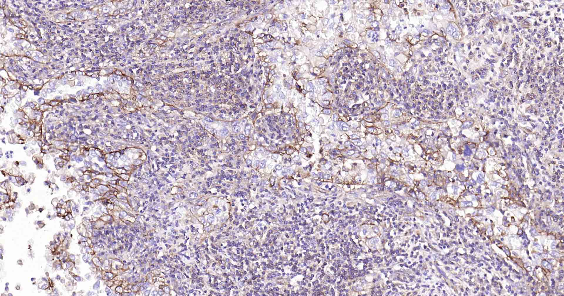 钠钾ATP酶蛋白a1重组兔单抗