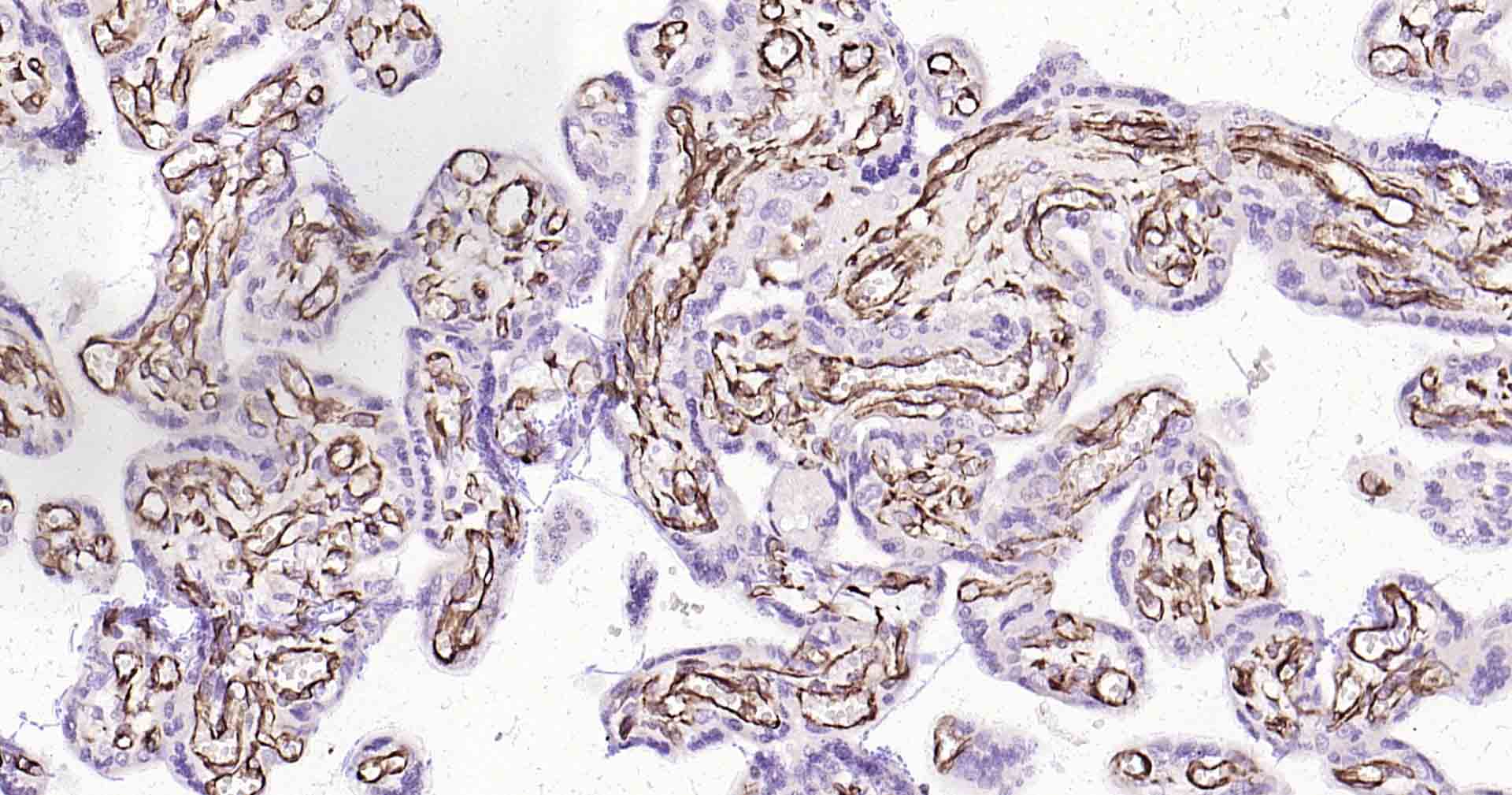 血管内皮生长因子重组兔单抗