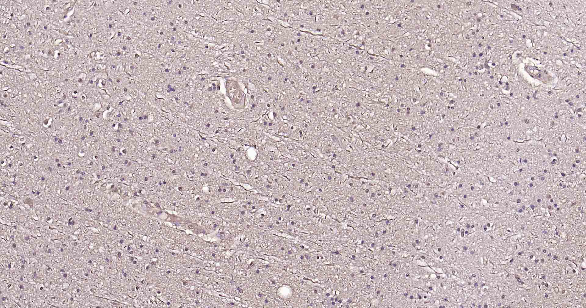 微管相关蛋白重组兔单抗