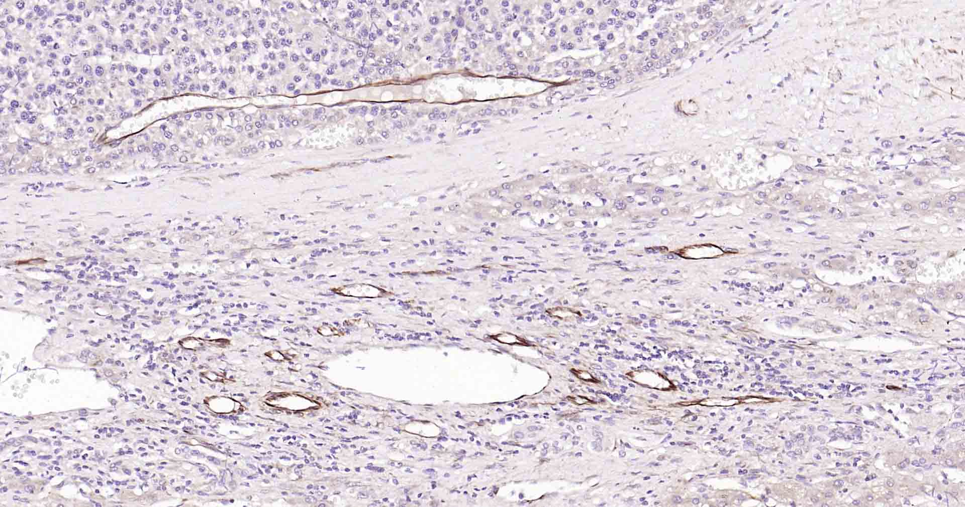 血管内皮生长因子重组兔单抗
