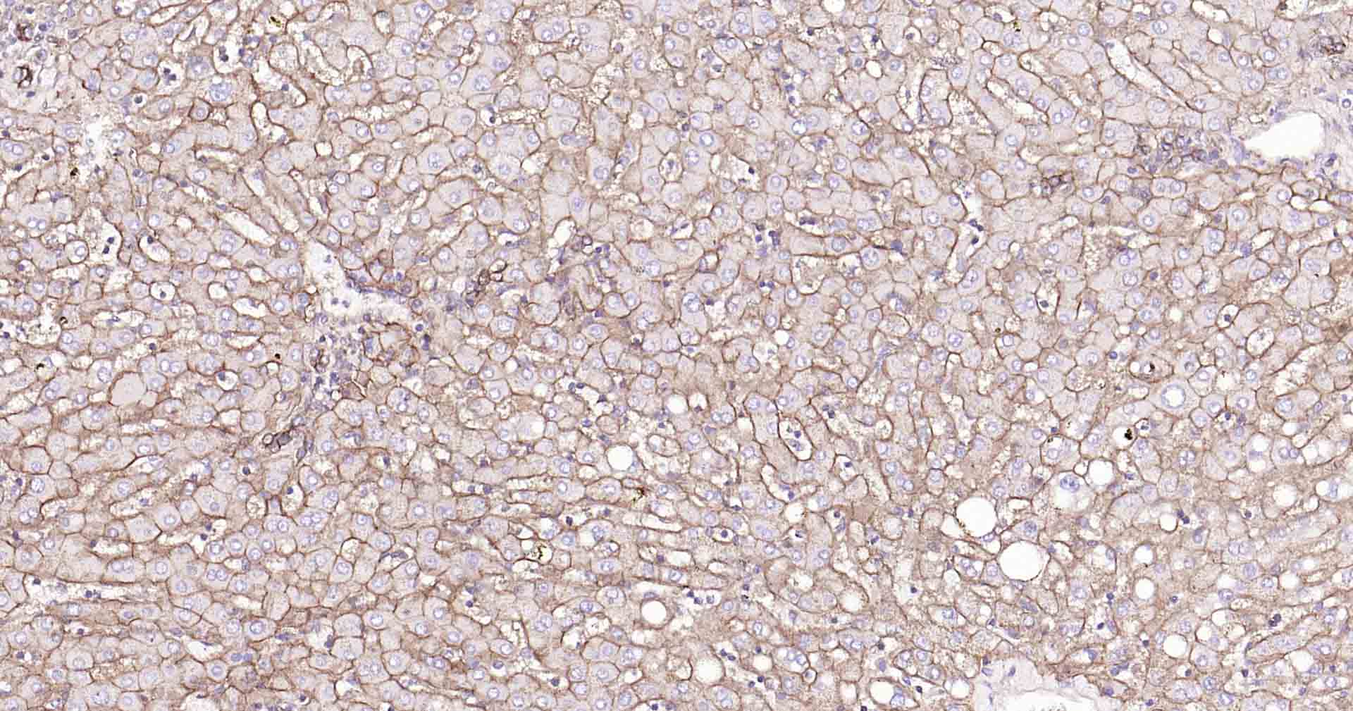 钠钾ATP酶蛋白a1重组兔单抗