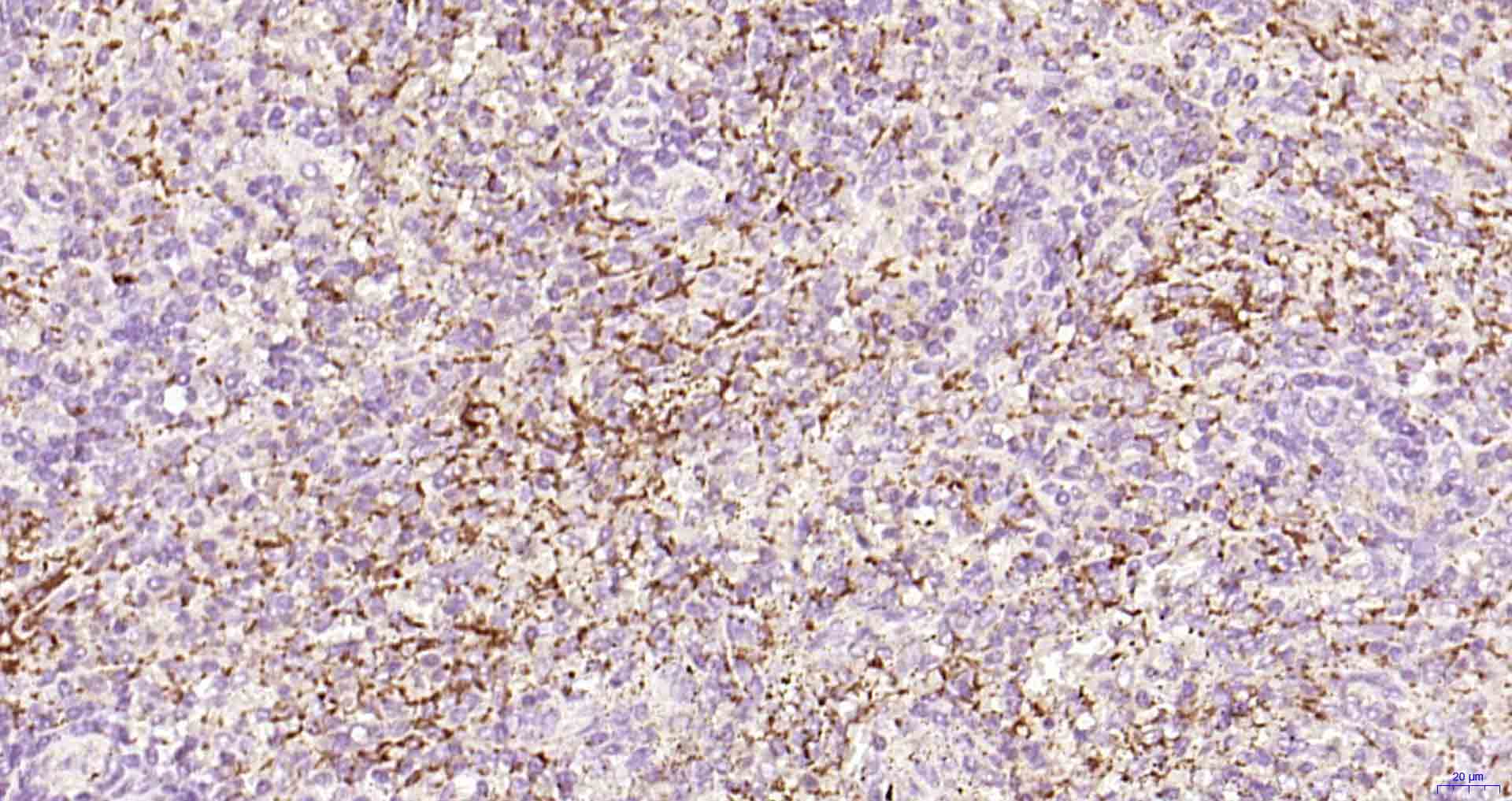 P选择素/白细胞内皮细胞粘附分子3重组兔单抗