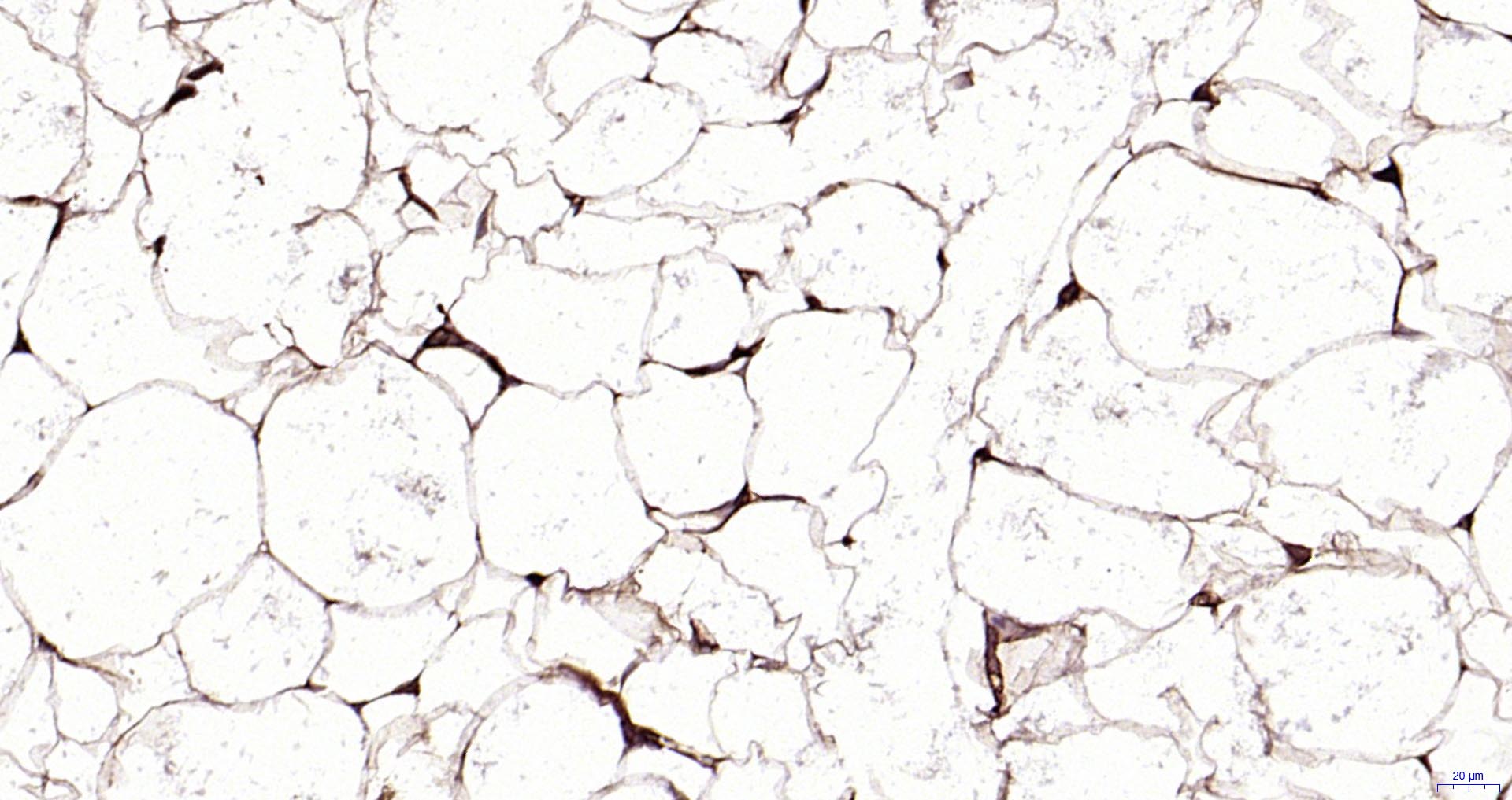 脂滴包被蛋白Perilipin-A重组兔单抗