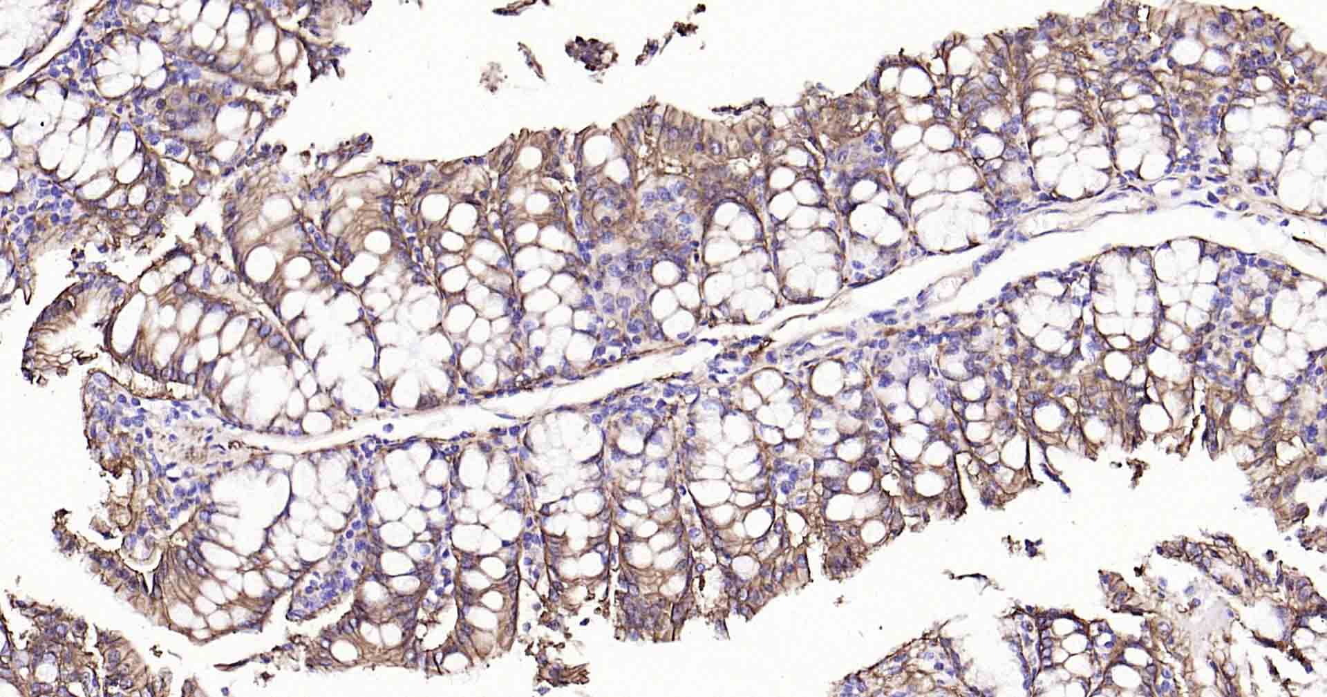 钠钾ATP酶蛋白a1重组兔单抗