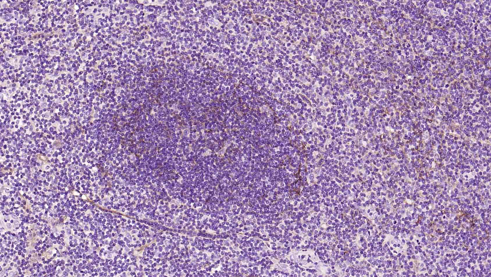 平足蛋白/淋巴管内皮细胞蛋白重组兔单抗