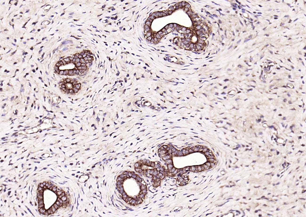 细胞角蛋白18抗体-bs-2043R