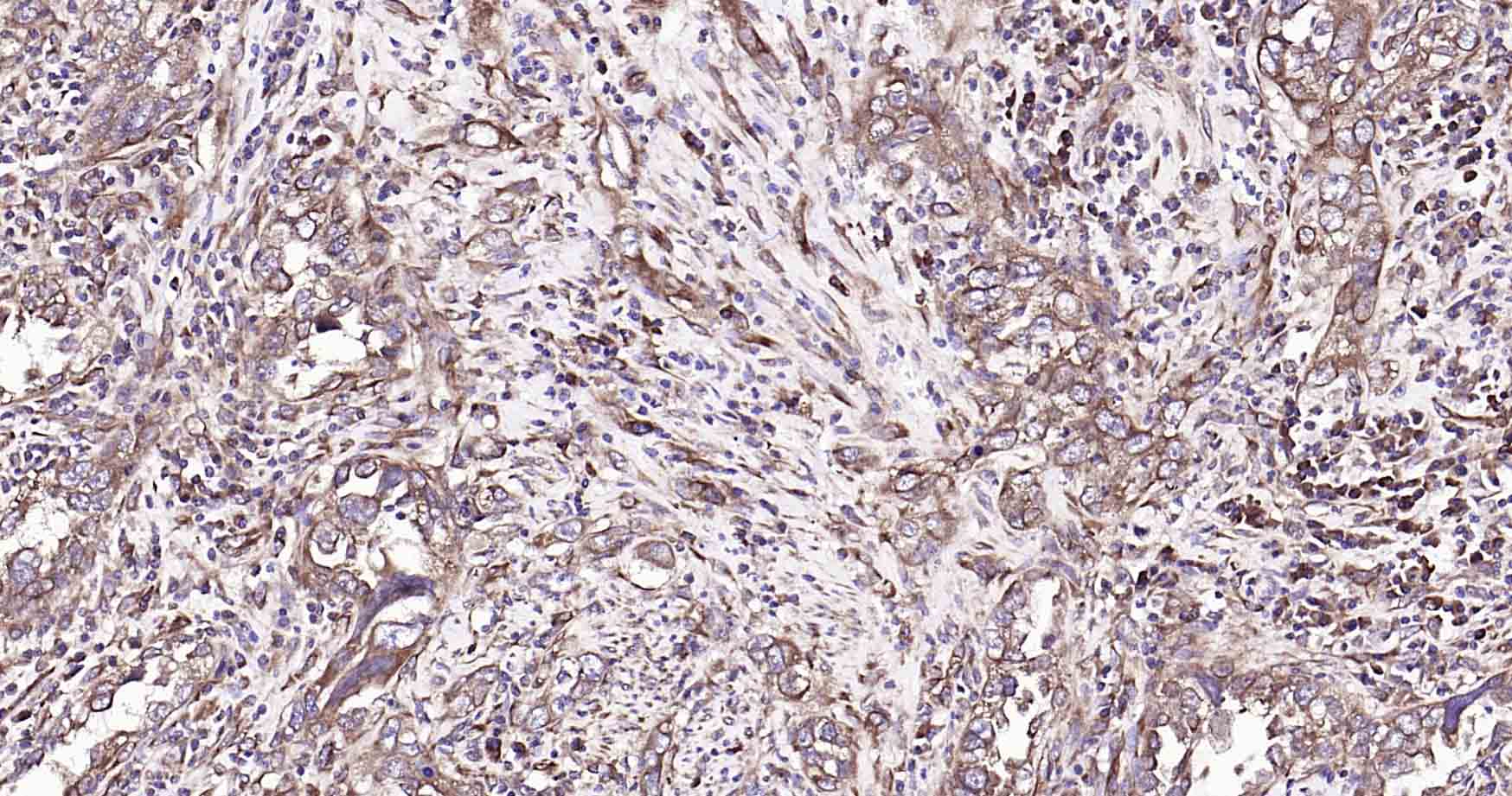 GADD153重组兔单抗