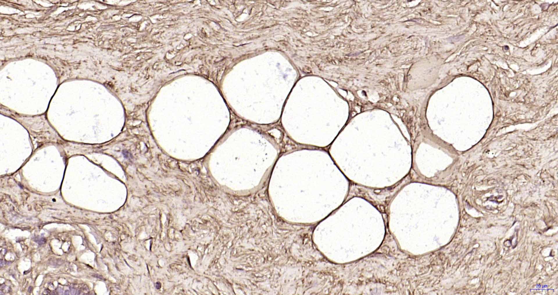 脂滴包被蛋白Perilipin-A重组兔单抗