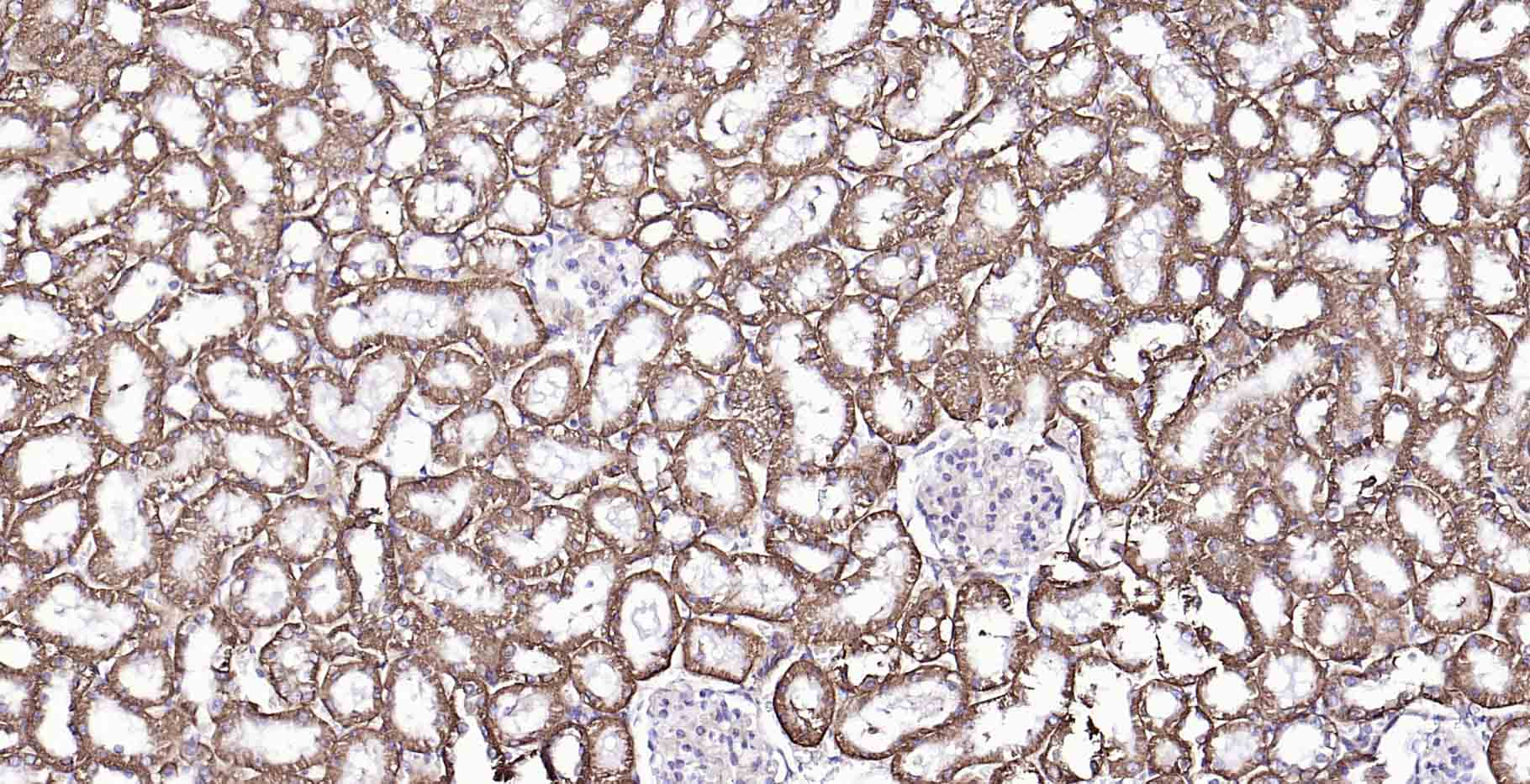 钠钾ATP酶蛋白a1重组兔单抗