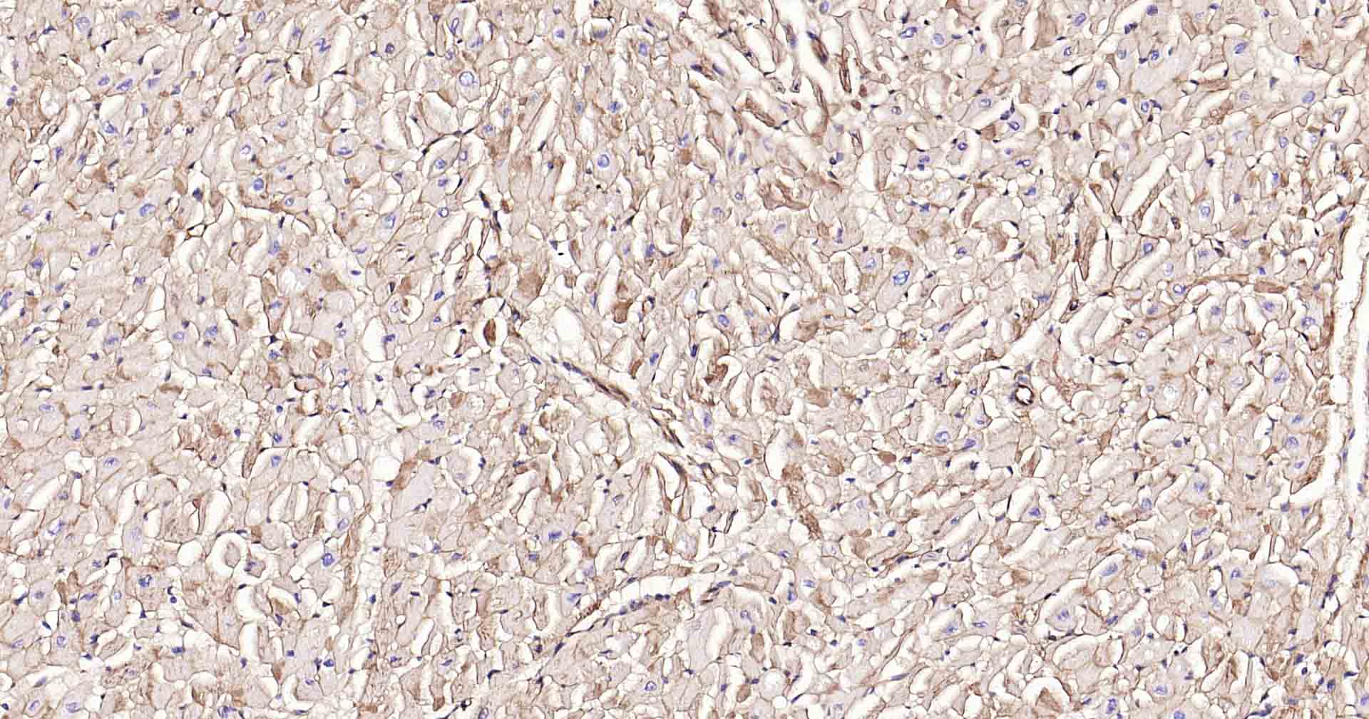 钠钾ATP酶蛋白a1重组兔单抗
