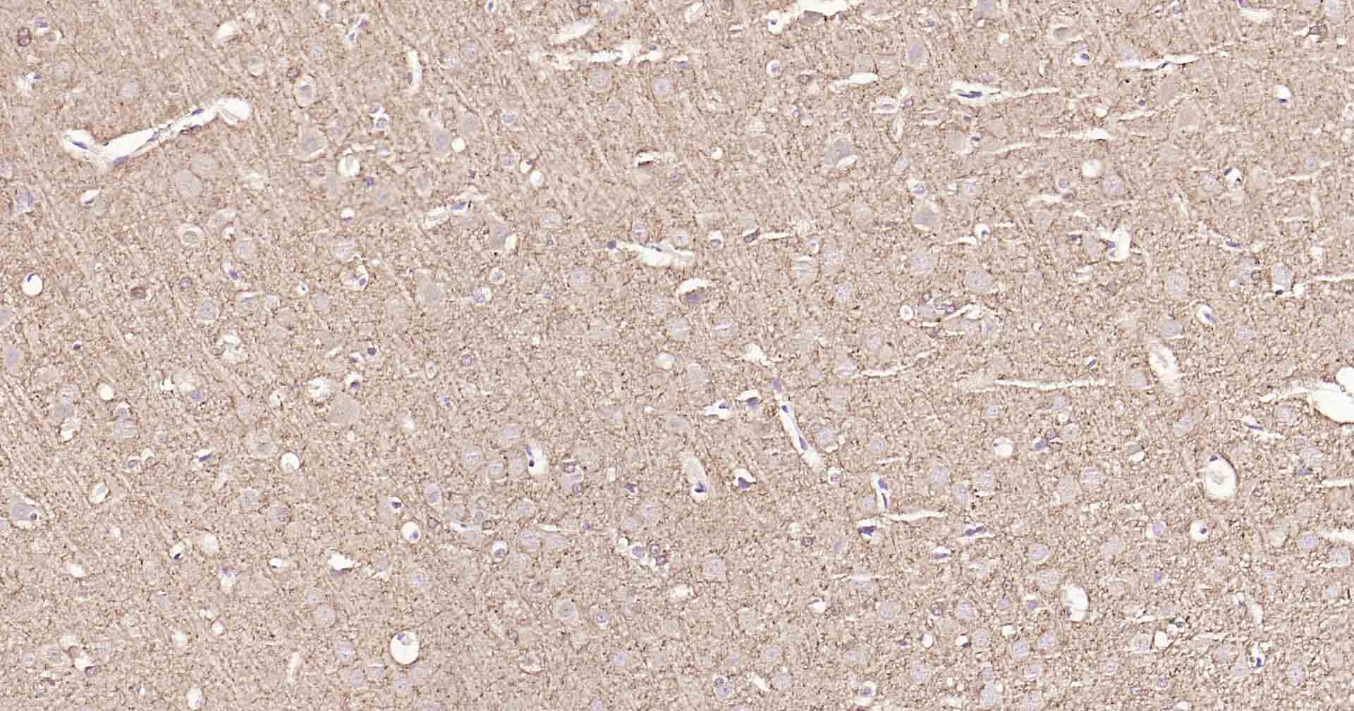 微管相关蛋白重组兔单抗