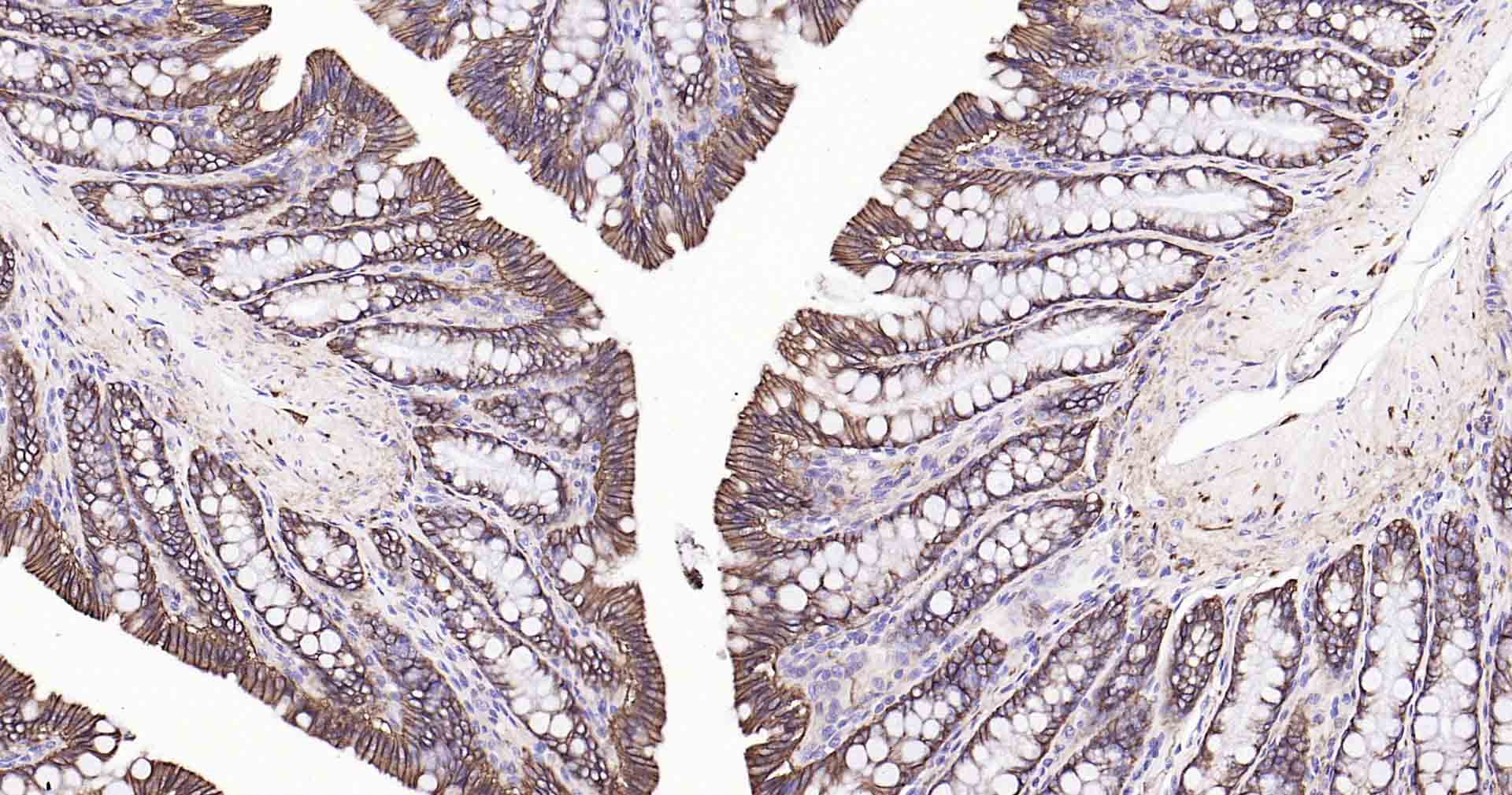 钠钾ATP酶蛋白a1重组兔单抗