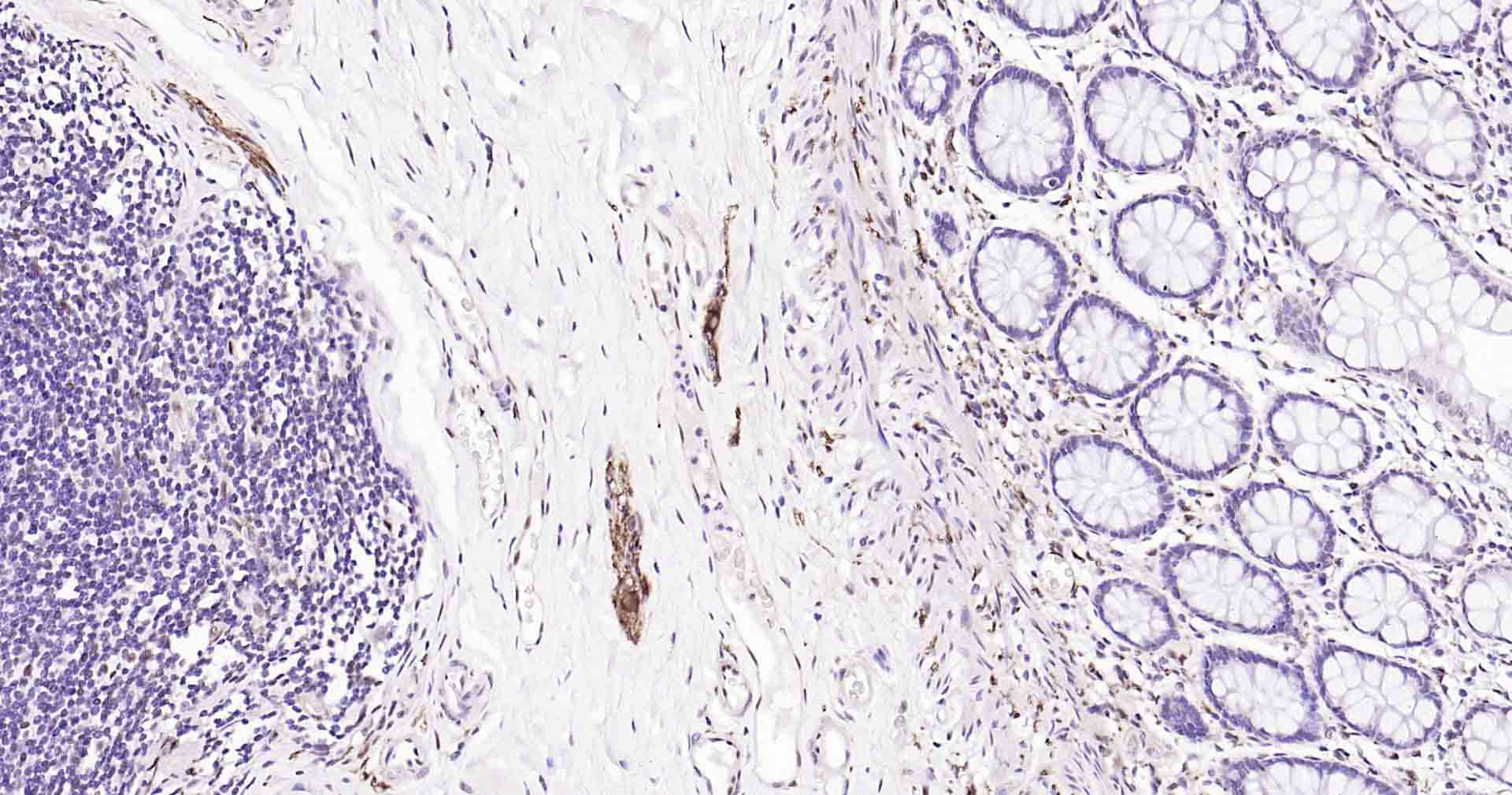 微管相关蛋白重组兔单抗