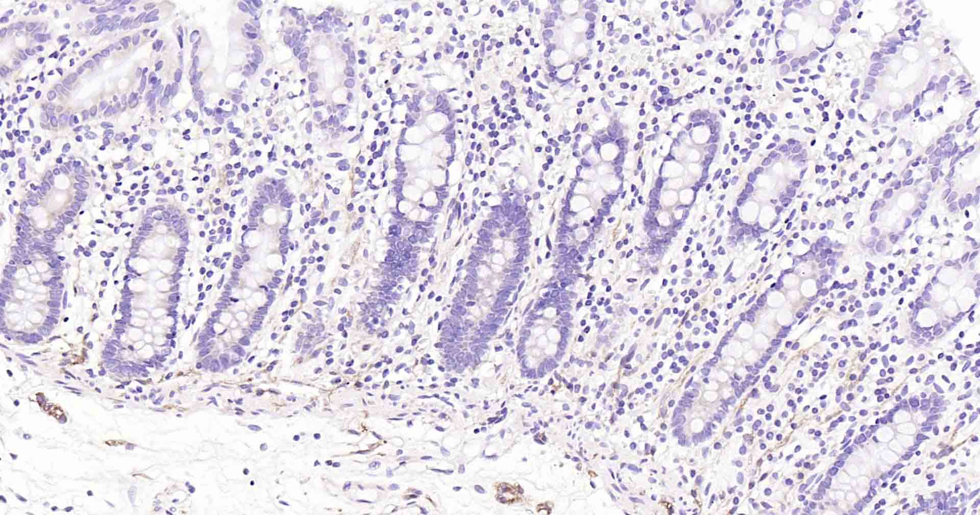 平足蛋白/淋巴管内皮细胞蛋白重组兔单抗