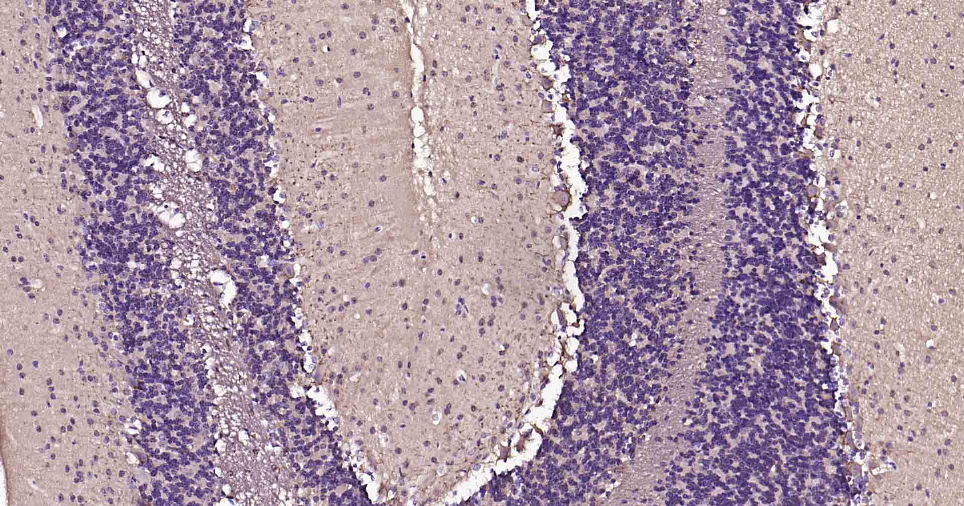 微管相关蛋白重组兔单抗