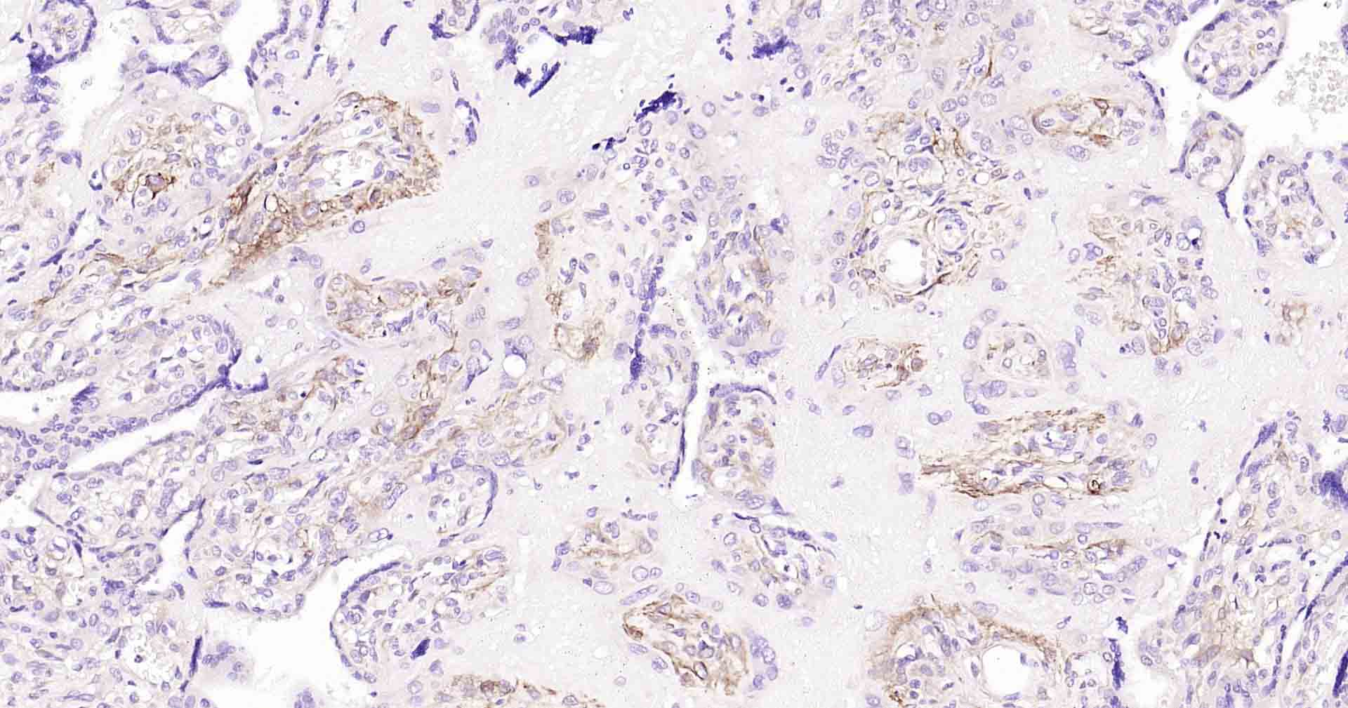 平足蛋白/淋巴管内皮细胞蛋白重组兔单抗