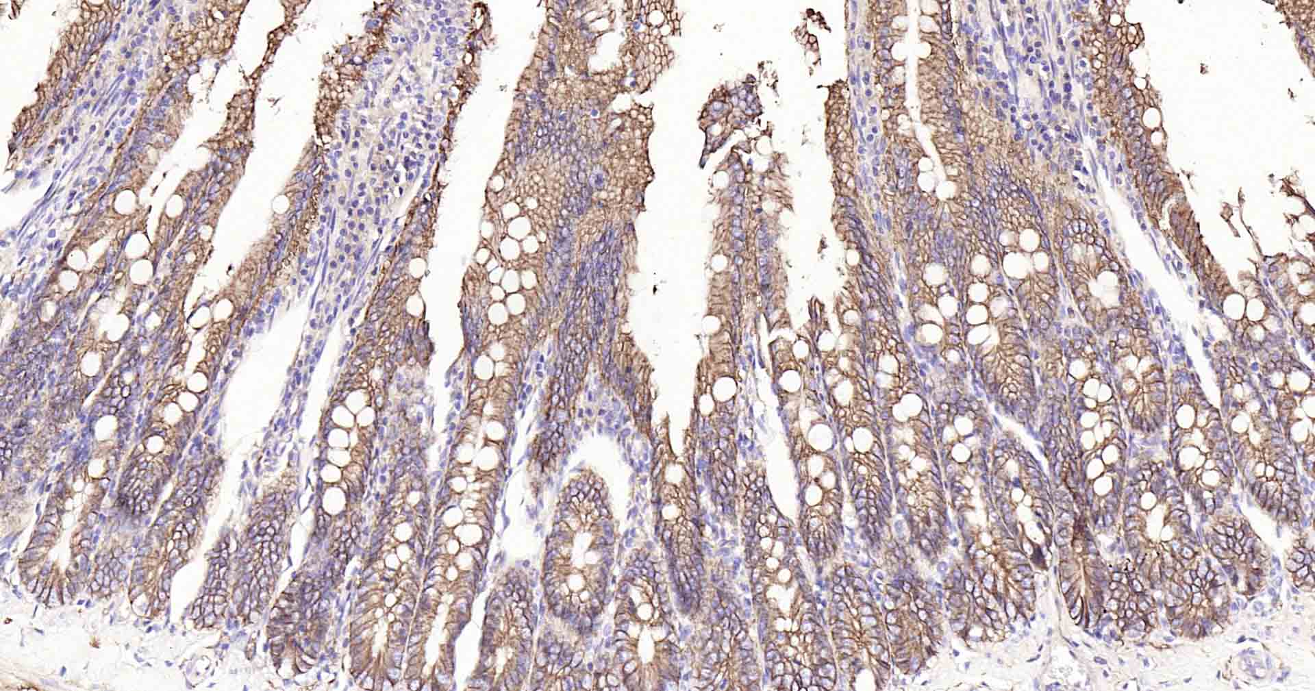 钠钾ATP酶蛋白a1重组兔单抗