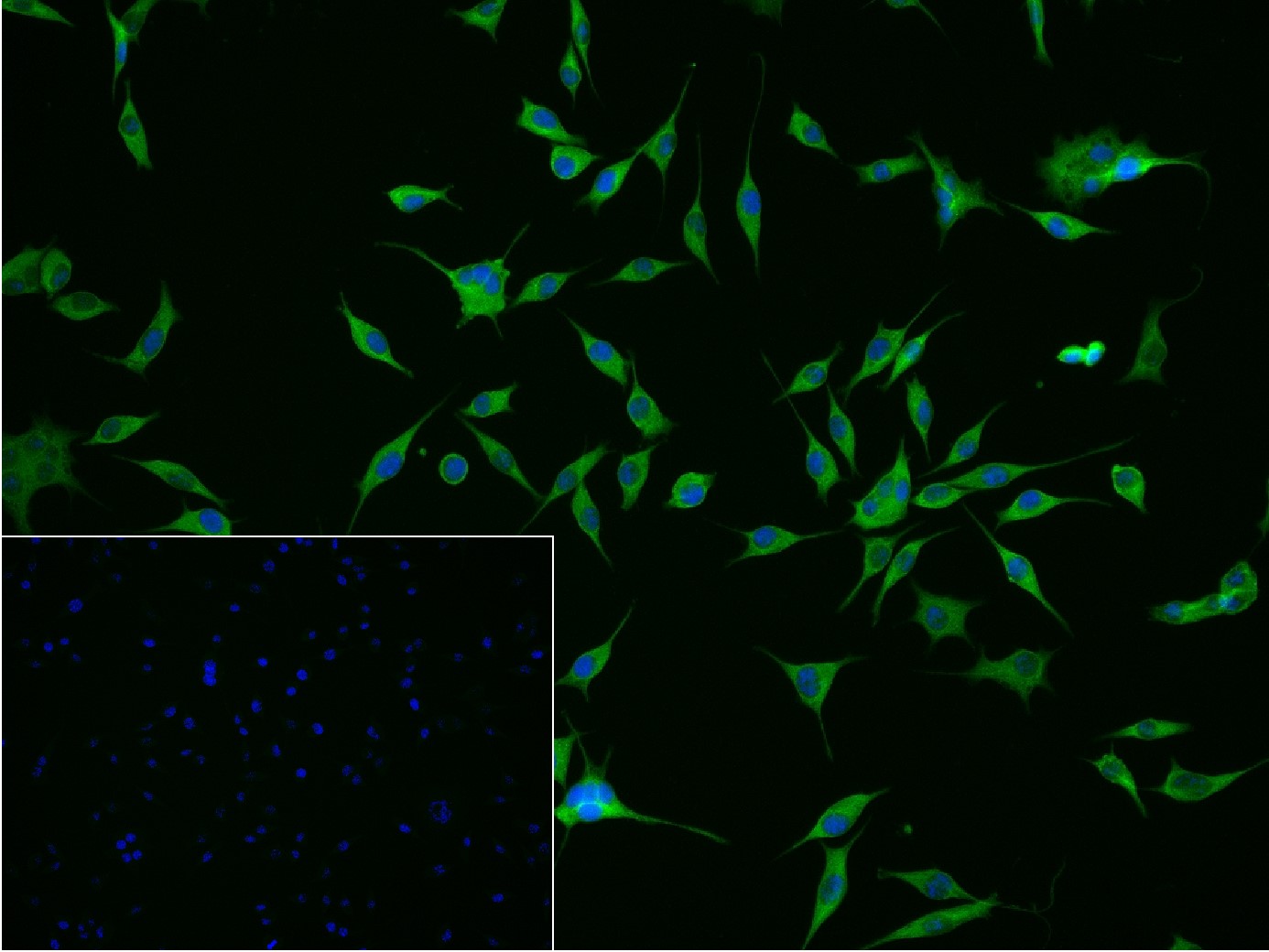 钙结合蛋白D28K抗体-bs-10177R