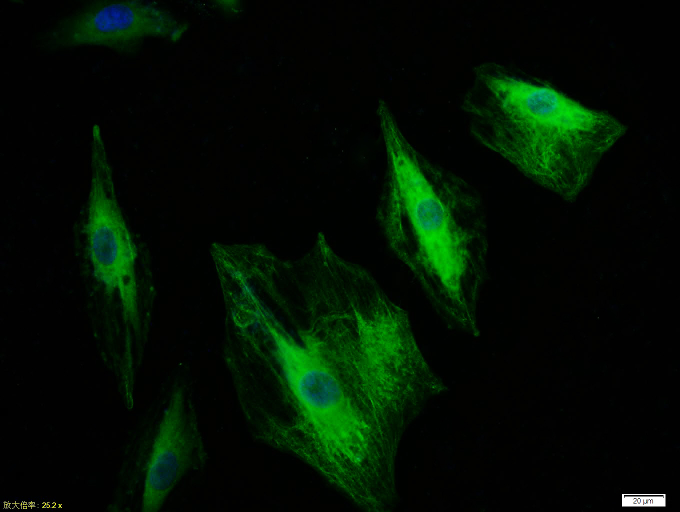 细胞角蛋白18抗体-bs-2043R