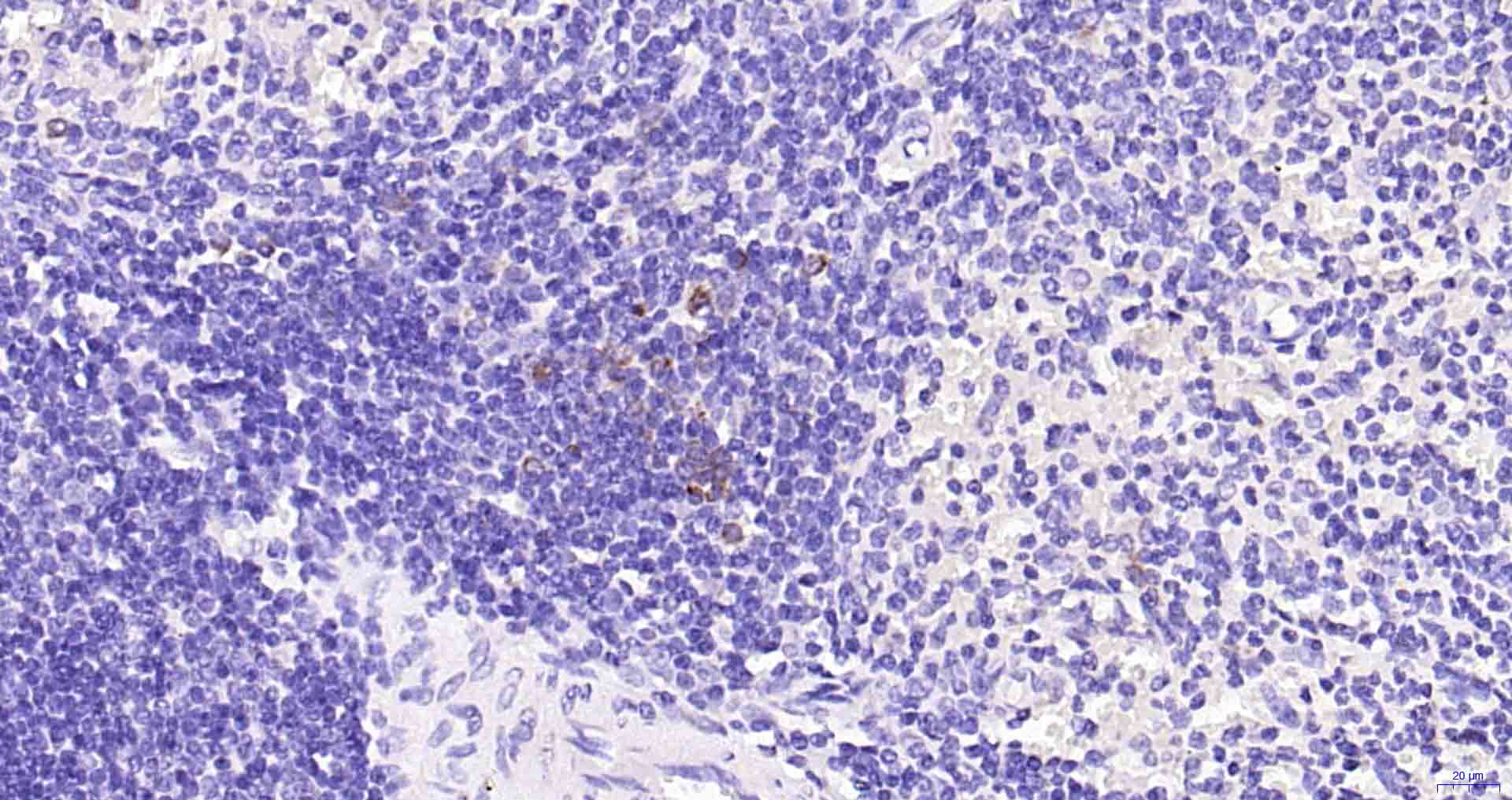 颗粒酶B重组兔单克隆抗体