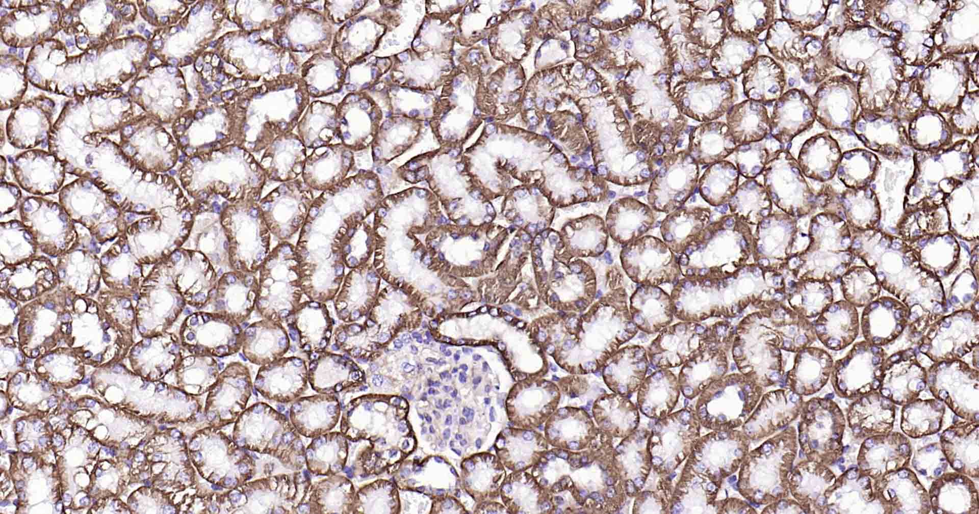 钠钾ATP酶蛋白a1重组兔单抗