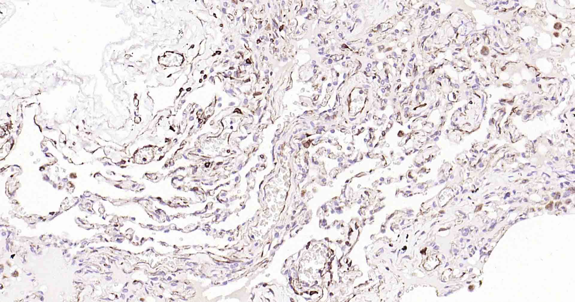 血管内皮生长因子重组兔单抗