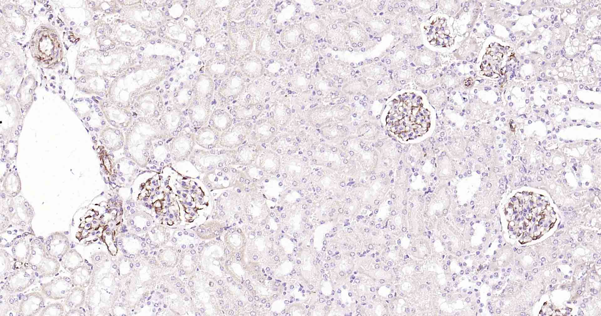 血管内皮生长因子重组兔单抗