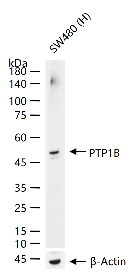 蛋白酪氨酸磷酸酶-1B重组兔单抗