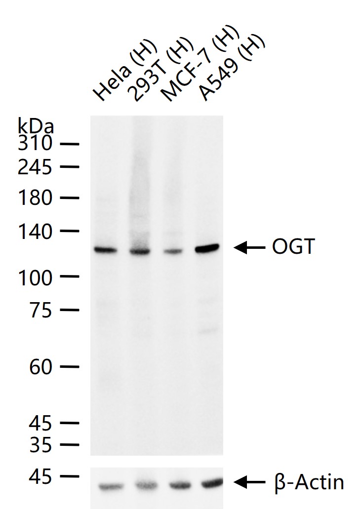 O位N-乙酰葡萄糖胺OGT重组兔单抗